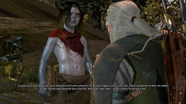 Visit Johnny to find out what happened to Anna. / Use your Witcher Senses to find Johnny.
